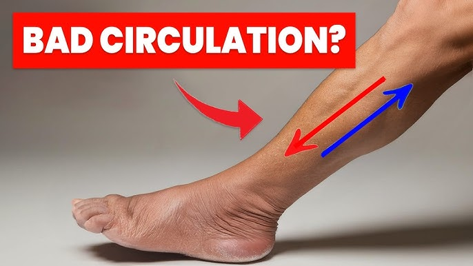 VIDEO | The ONLY 3 Exercises you NEED to Improve Leg Circulation
